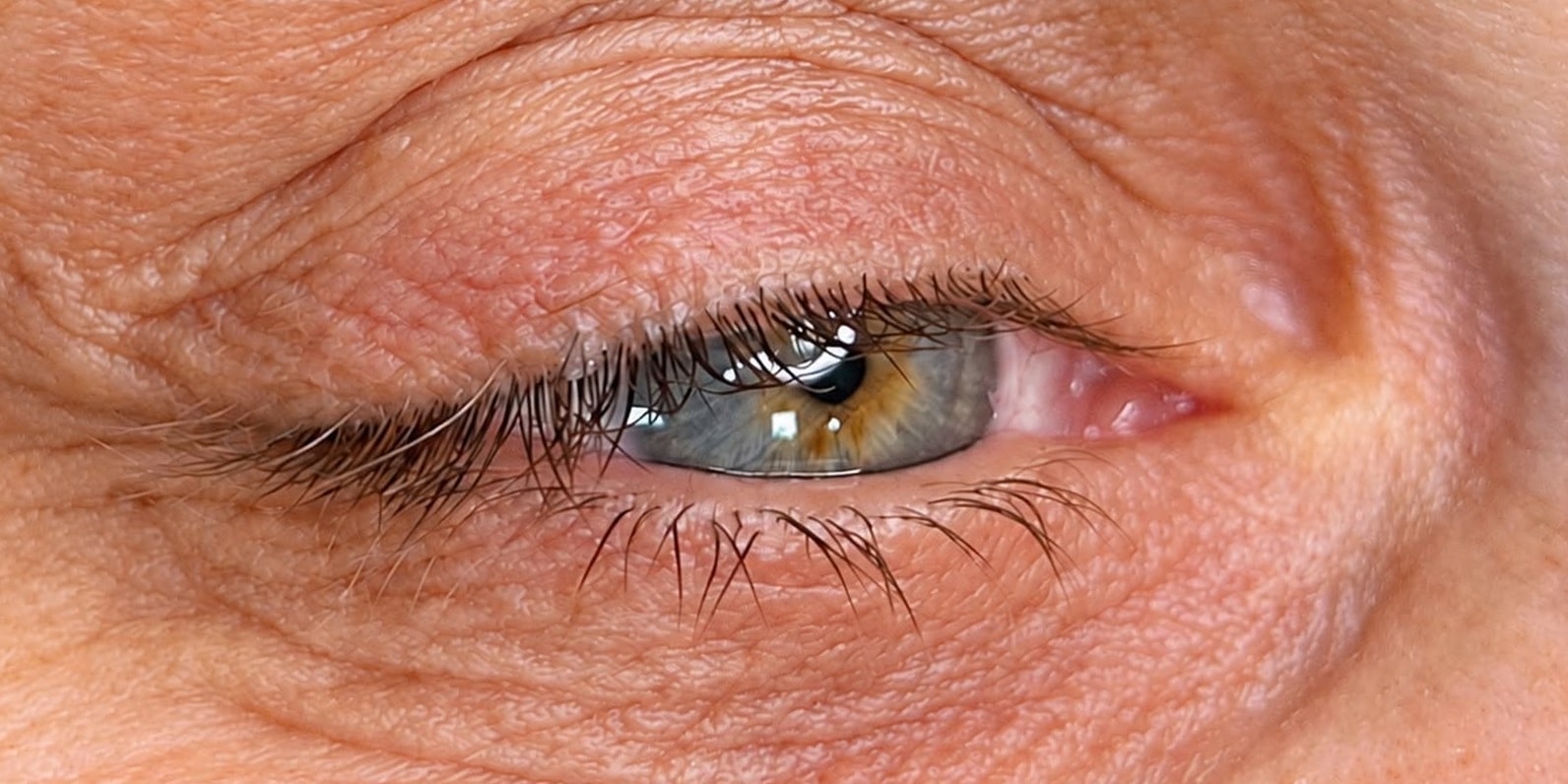 EyeLiner: antes da micropigmentação