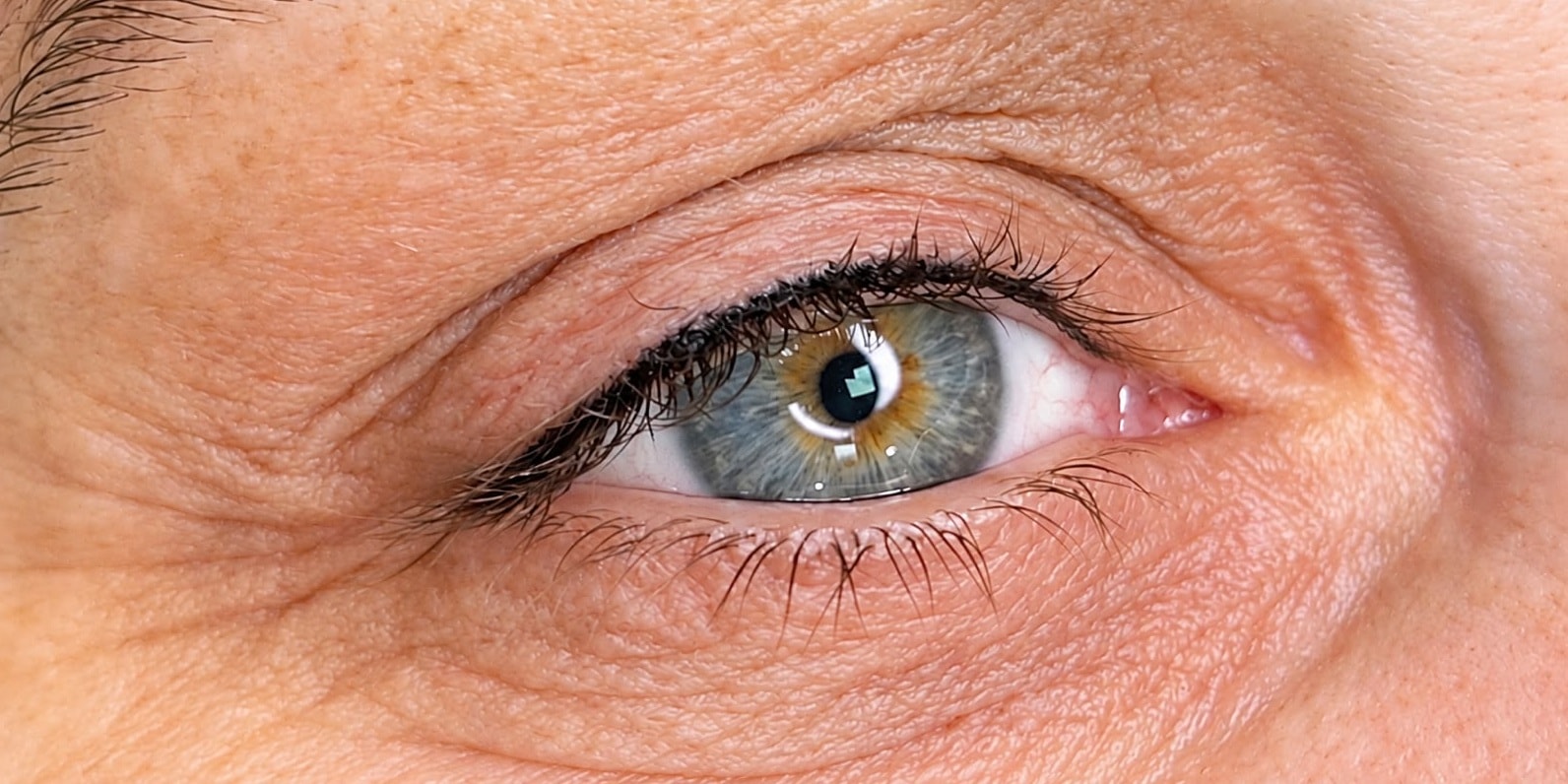 EyeLiner: resultado depois da micropigmentação