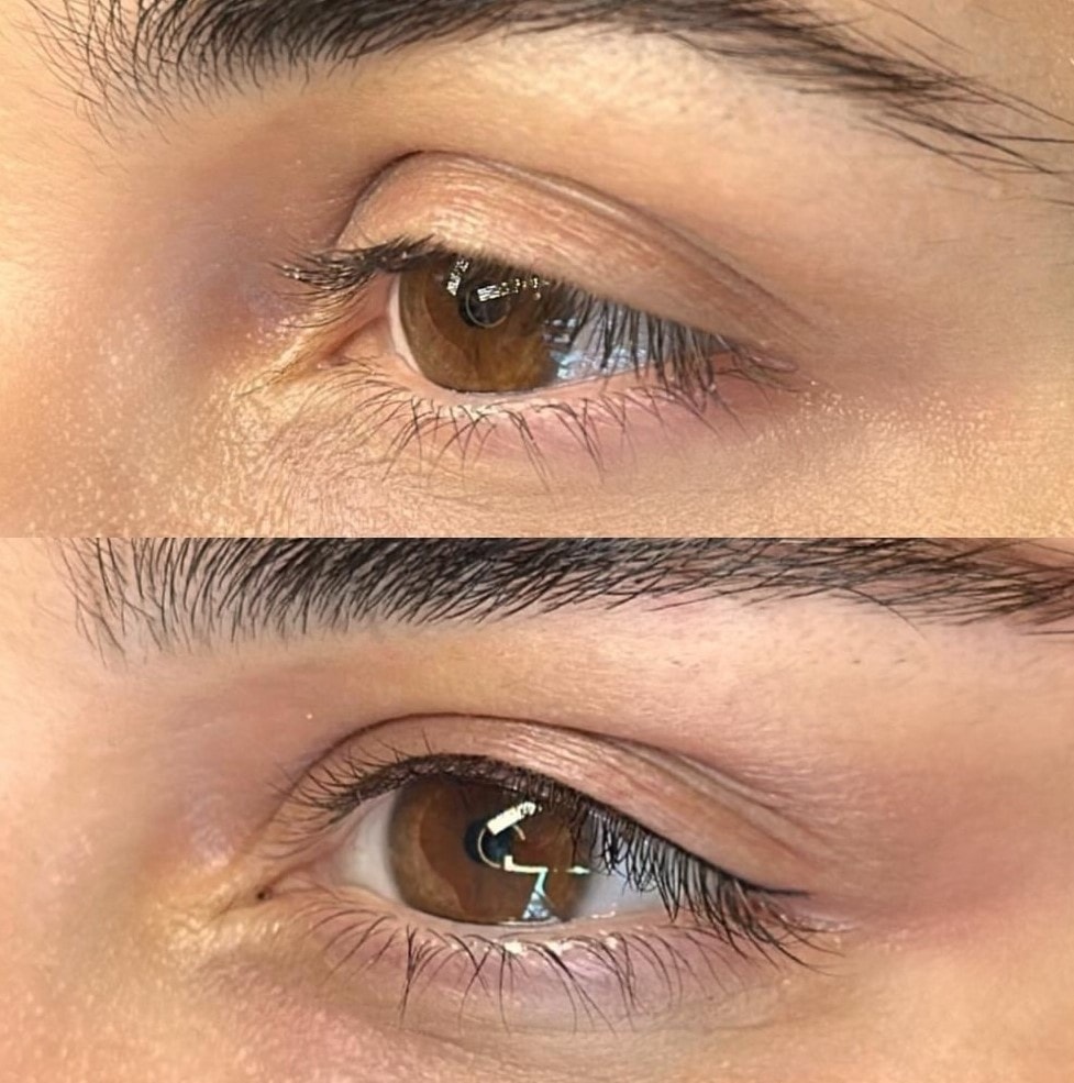 EyeLiner: resultado de micropigmentação por Judy Mascarenhas