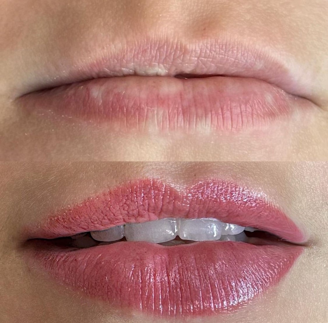 Revitalização Labial: resultado de micropigmentação por Judy Mascarenhas
